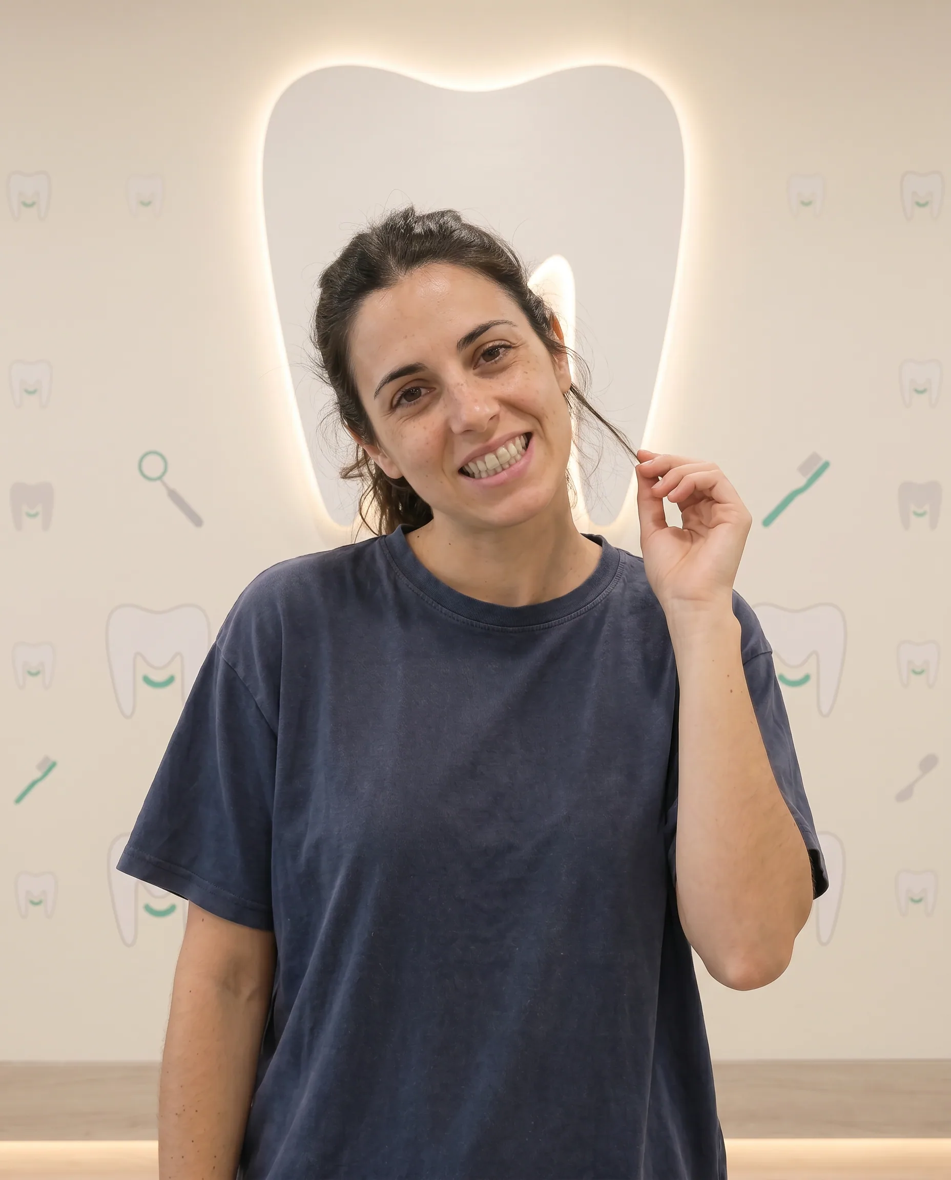 Caso de blanqueamiento combo en tinción por tetraciclina leve antes — MAKEDA Barcelona
