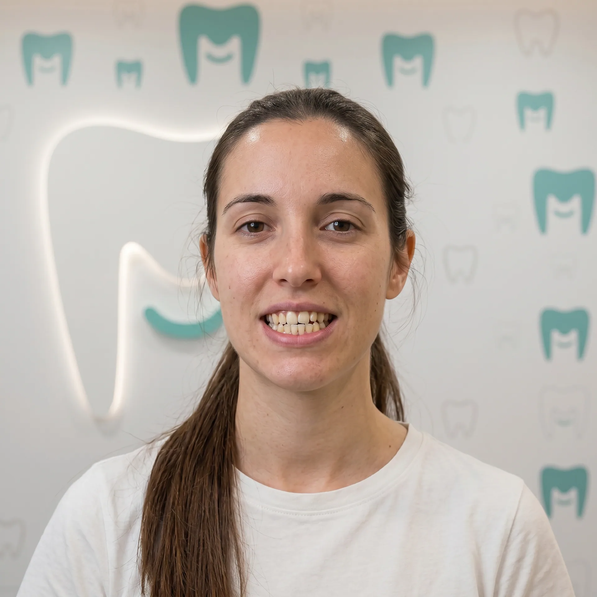 Caso de ortodoncia invisible MAKEDA smile. antes — mordida cruzada anterior